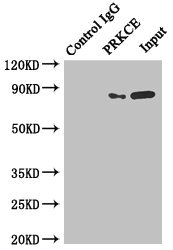 Anti-PRKCE Antibody