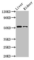 Anti-PTGER4 Antibody