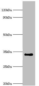 Anti-RAD1 Antibody