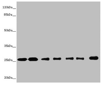 Anti-RALB Antibody