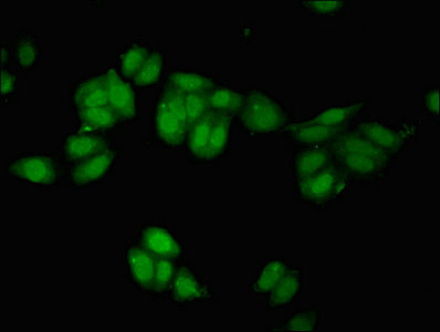 Anti-REST Antibody