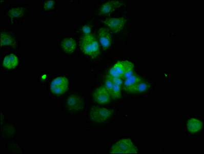 Anti-RFX2 Antibody