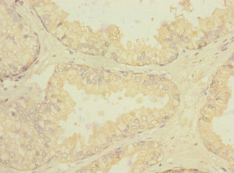 Anti-RGR Antibody