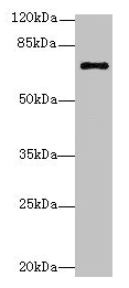 Anti-RHOBTB3 Antibody