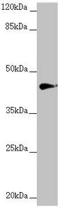 Anti-RNF13 Antibody