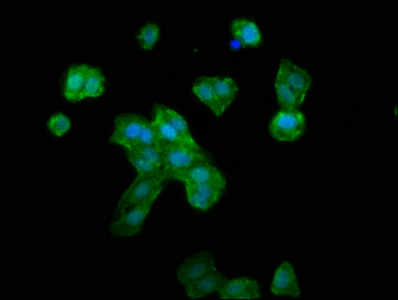 Anti-RNF39 Antibody