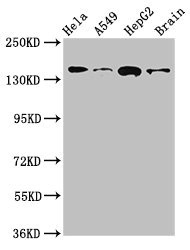 Anti-ROCK2 Antibody
