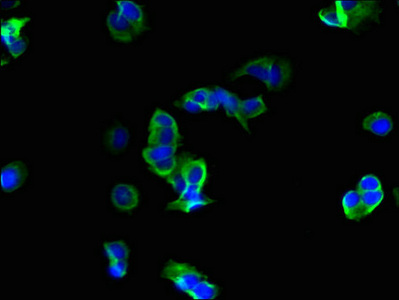 Anti-ROMO1 Antibody