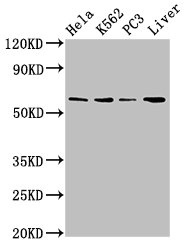 Anti-RORA Antibody
