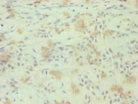 Anti-RORC Antibody