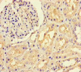 Anti-LTBP4 Antibody