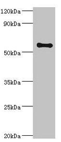 Anti-SCP2 Antibody