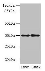 Anti-SDSL Antibody