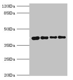 Anti-SEPHS1 Antibody