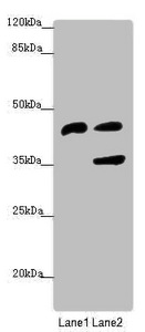 Anti-SERPINB6 Antibody
