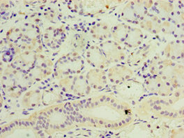 Anti-SESN3 Antibody
