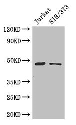 Anti-SGK1 Antibody