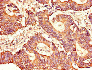 Anti-SH2D1B Antibody