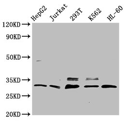 Anti-GEMIN2 Antibody