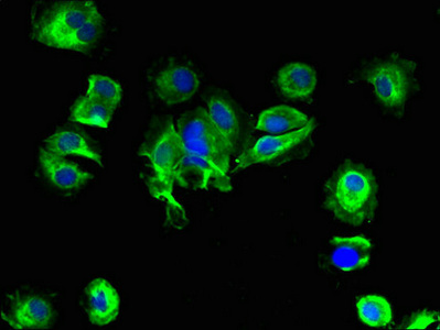Anti-SLC25A14 Antibody