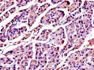 Anti-SPINK1 Antibody