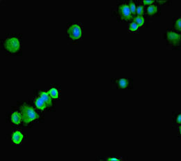 Anti-SSRP1 Antibody