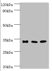 Anti-SULT1A3 Antibody