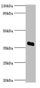 Anti-SULT2A1 Antibody