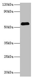 Anti-SUOX Antibody