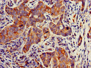 Anti-TECPR2 Antibody