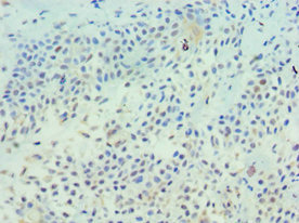 Anti-TFF1 Antibody
