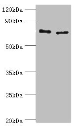 Anti-TGM2 Antibody