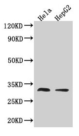 Anti-TMEM192 Antibody