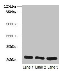 Anti-GM2A Antibody
