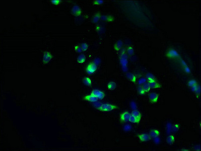 Anti-TMEM63A Antibody
