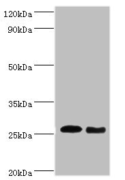 Anti-TNF Antibody