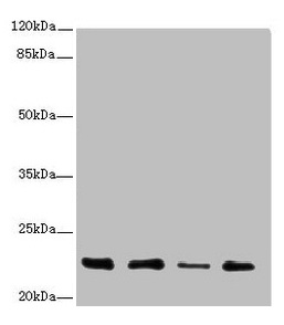 Anti-TNFAIP8 Antibody