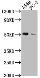 Anti-TNFRSF1A Antibody