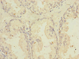 Anti-TNFSF15 Antibody