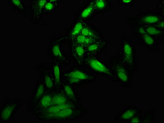 Anti-TOP1 Antibody