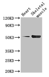 Anti-TPH1 Antibody