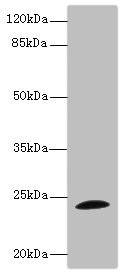 Anti-TPPP Antibody
