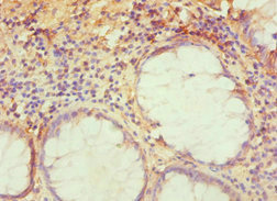 Anti-TRAF3IP2 Antibody