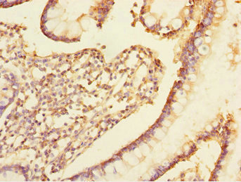 Anti-TRIAP1 Antibody