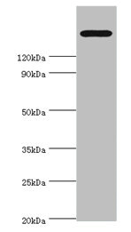Anti-TRPM2 Antibody