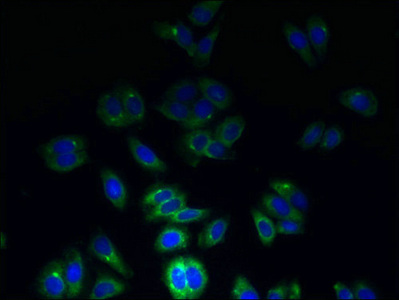 Anti-TSPAN7 Antibody