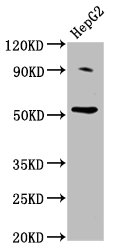 Anti-U2AF2 Antibody