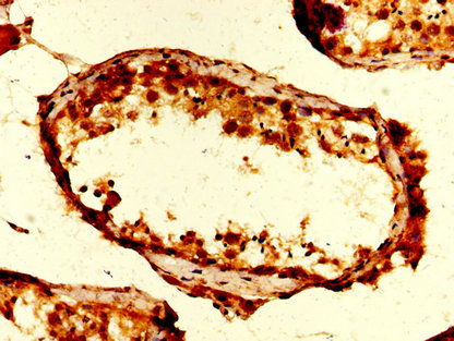 Anti-UBA52 Antibody