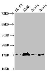Anti-UBE2V2 Antibody
