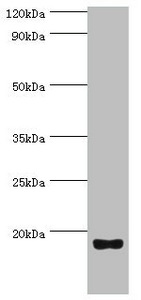 Anti-UTS2 Antibody